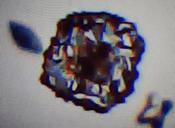 Protein Crystal Zoom